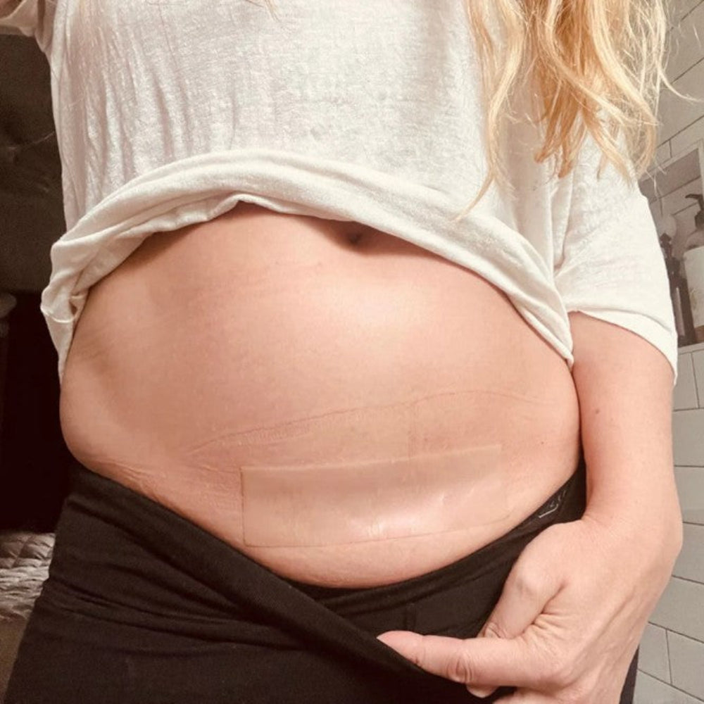 Mumasil C-Section Silicone Gel Strips